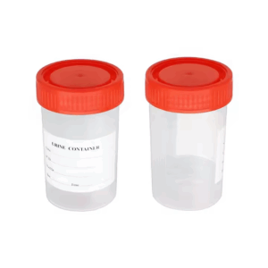 Urine Container with Screw Cap