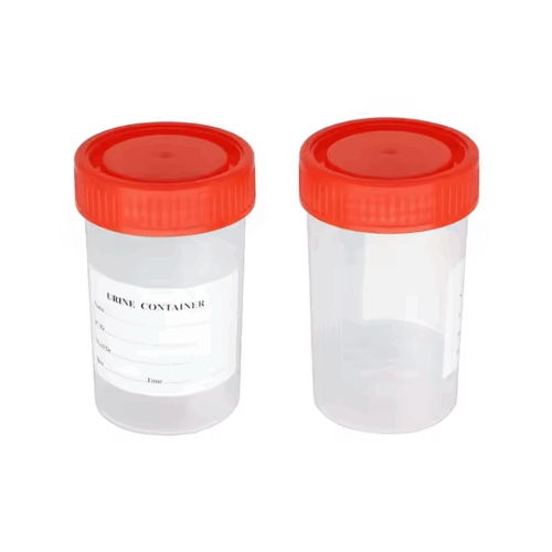 Urine Container with Screw Cap