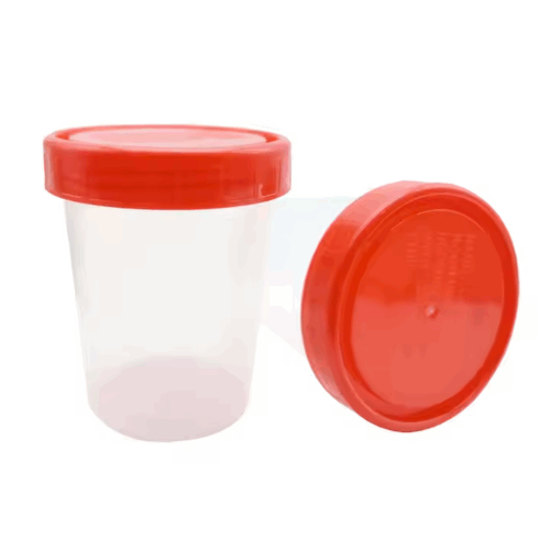 Urine Container with Screw Cap